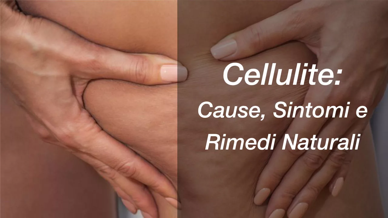 Cellulite: Cause, Sintomi e Rimedi Naturali